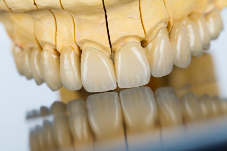 An abstract view of a beautiful porcelain bridge made by dental technician.
